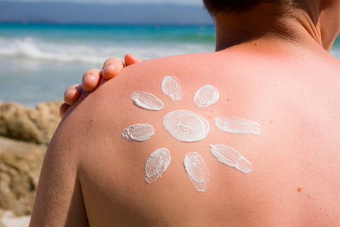 Eritema solare come prevenirlo